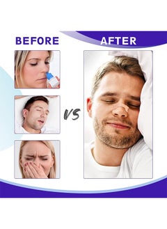HY Nasal Strips for Snoring, 100 Pcs Nose Strips for Breathing Sleeping Help Stop Snoring Relieve Nasal Congestion Nasal Strips Snoring Devices for Men Women Anti Snore Strips  - Image 2