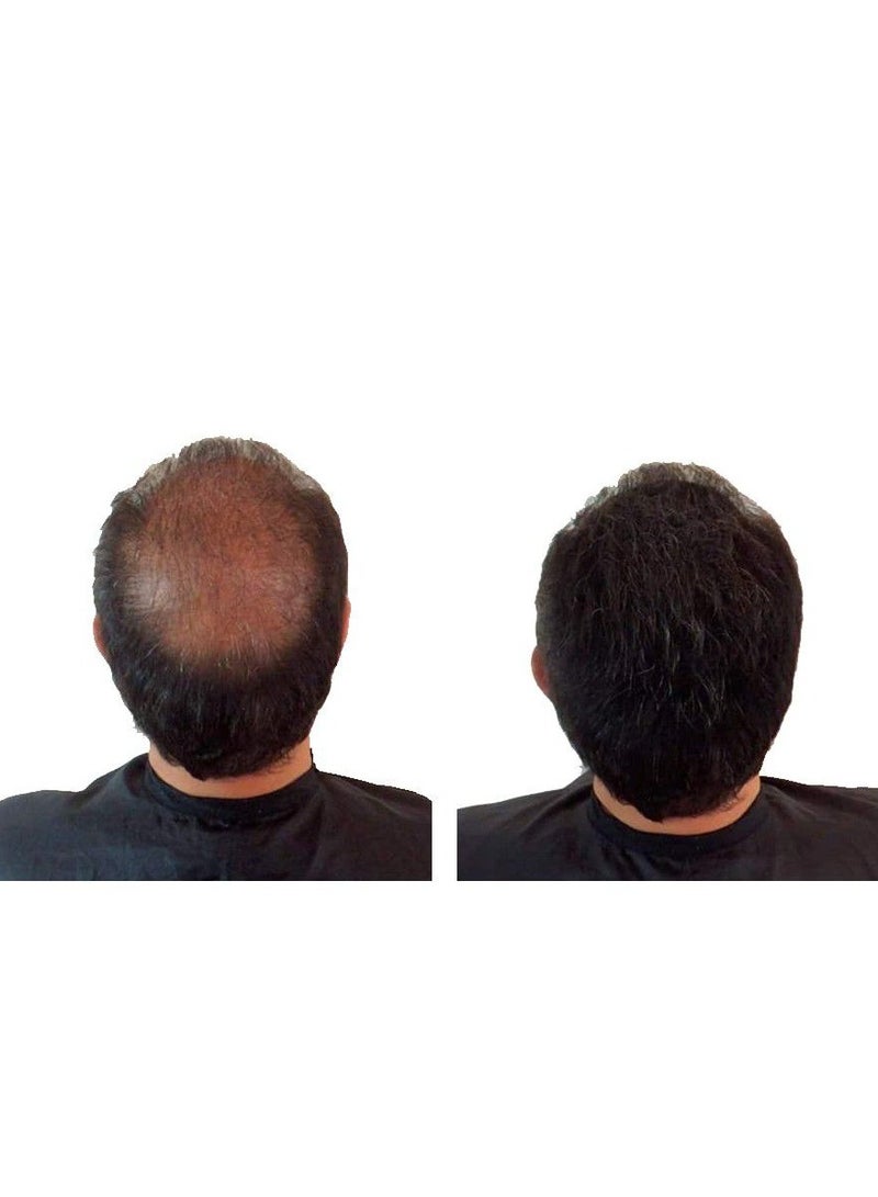 Toppik Hair Building Fibers Medium Brown - Image 5