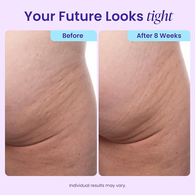 goPure Firming Butt & Thigh Cream  Smooths the look of dimpled texture, fades the look of stretch marks - Clinically Tested - Image 3