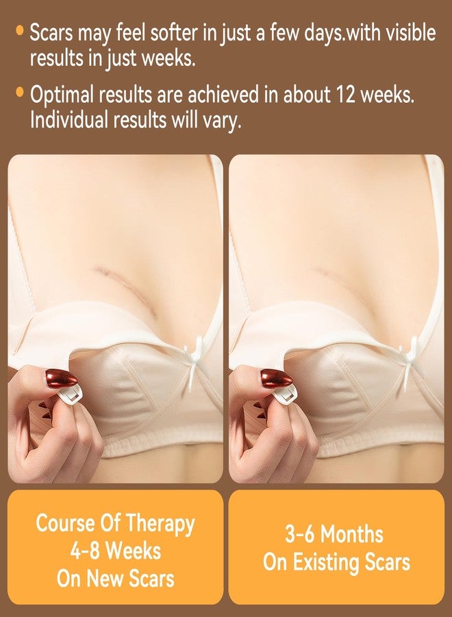 Nubical Including 8 Areola Soft Strips & 4 Anchor Sheets, Silicone Scar Sheets for Breast - Medical Grade Breast Silicone Scar Tape Patches for Surgical Scars - Image 5