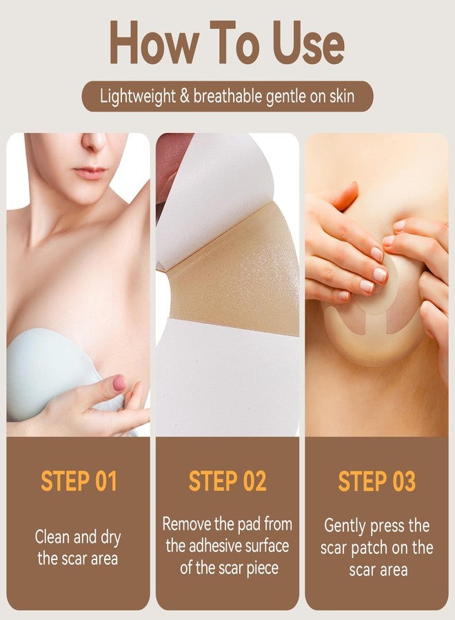 Nubical Including 8 Areola Soft Strips & 4 Anchor Sheets, Silicone Scar Sheets for Breast - Medical Grade Breast Silicone Scar Tape Patches for Surgical Scars - Image 3