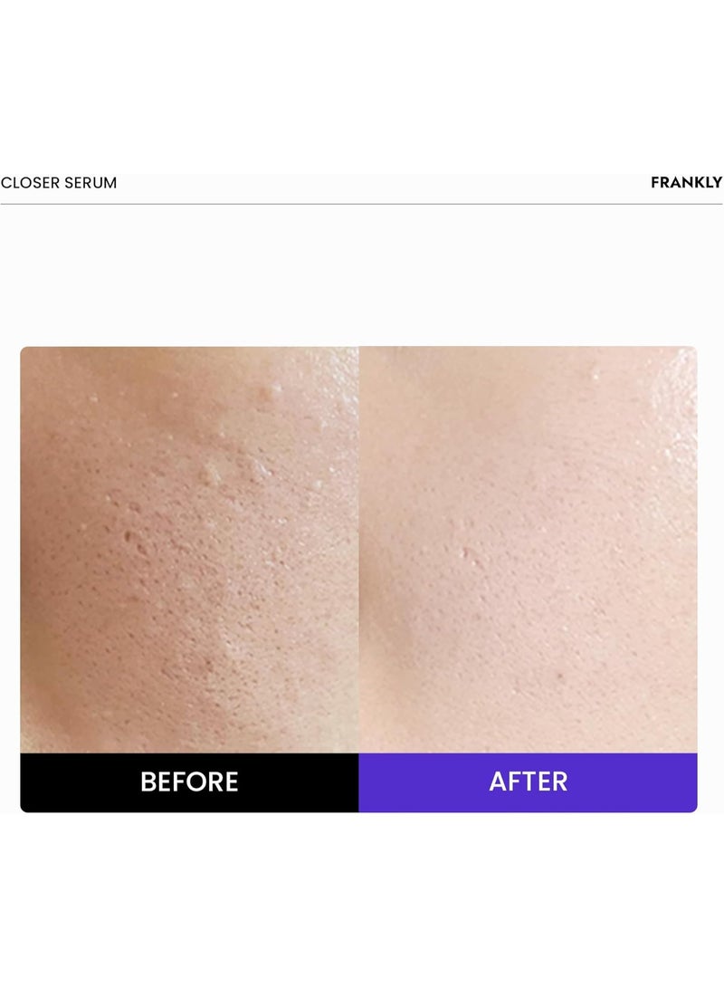 Frankly Closer Serum - 9 Peptides & Vegan Collagen, Pore Minimizer & Anti-Aging | 30ml - Image 4