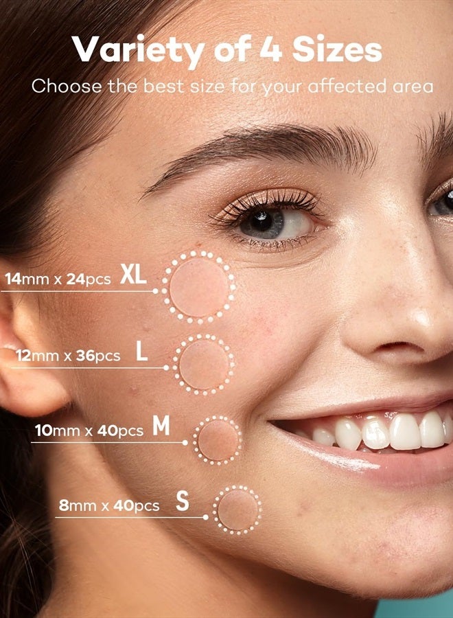 TKTK لصقات حب الشباب، 4 أحجام 140 لصقة تغطية حب الشباب، لصقات حب الشباب الهيدروكوليد غير المرئية للوجه، لصقات حب الشباب بزيت شجرة الشاي وزيت القطيفة - Image 2