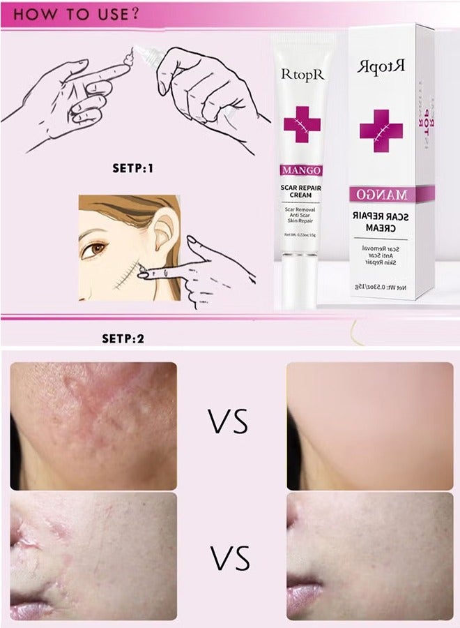 RtopR Scar Removal Cream Skin Repair Creams Treatment Stretch Marks Acne Surgical Care 15g  - Image 4