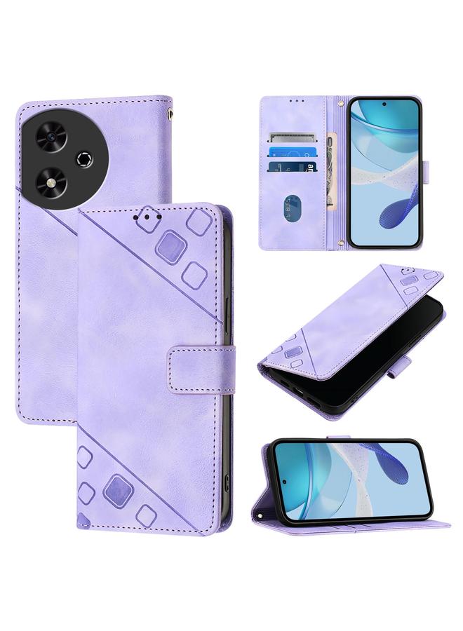 S-TOP Case For Honor Play 50 Skin-feel Embossed Leather Phone Case - Image 1