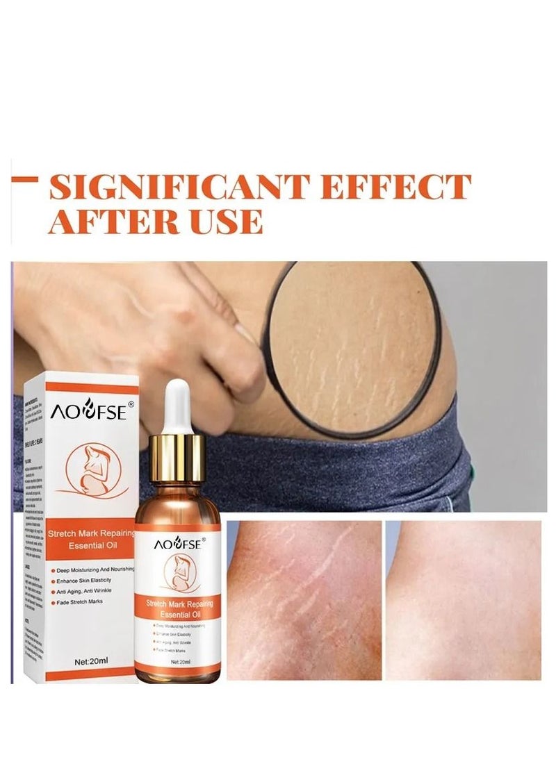 EELHOE Pure Natural Maternity Skin Care Body Oil Scar Repair Removal Stretch Marks Oil 20 ml - Image 3
