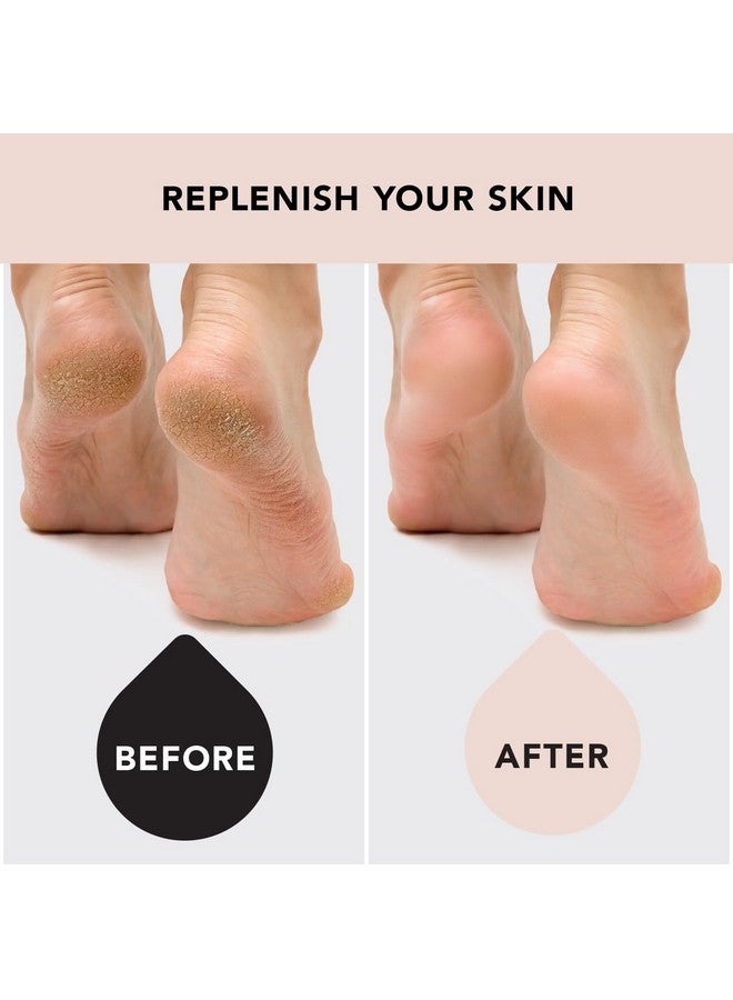Kitsch Moisturizing Socks For Cracked Heel Treatment, Insulated Gel Socks & Moisturizing Heel Socks For Dry Cracked Feet Women Men, Spa & Sleep Socks For Overnight Moisture Repair, 1 Reusable Pair - Image 5