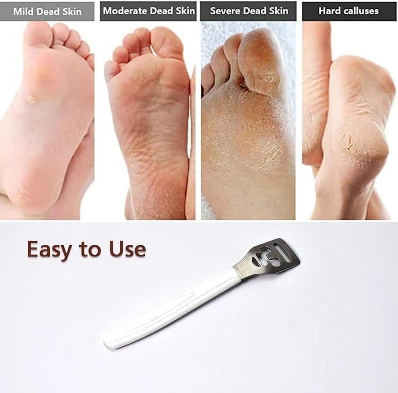 Foot Callus Remover, Professional Foot File with Stainless Steel Blade, Pedicure Exfoliator for Heels and Dry Skin, White Handle, 1 Piece - Image 2