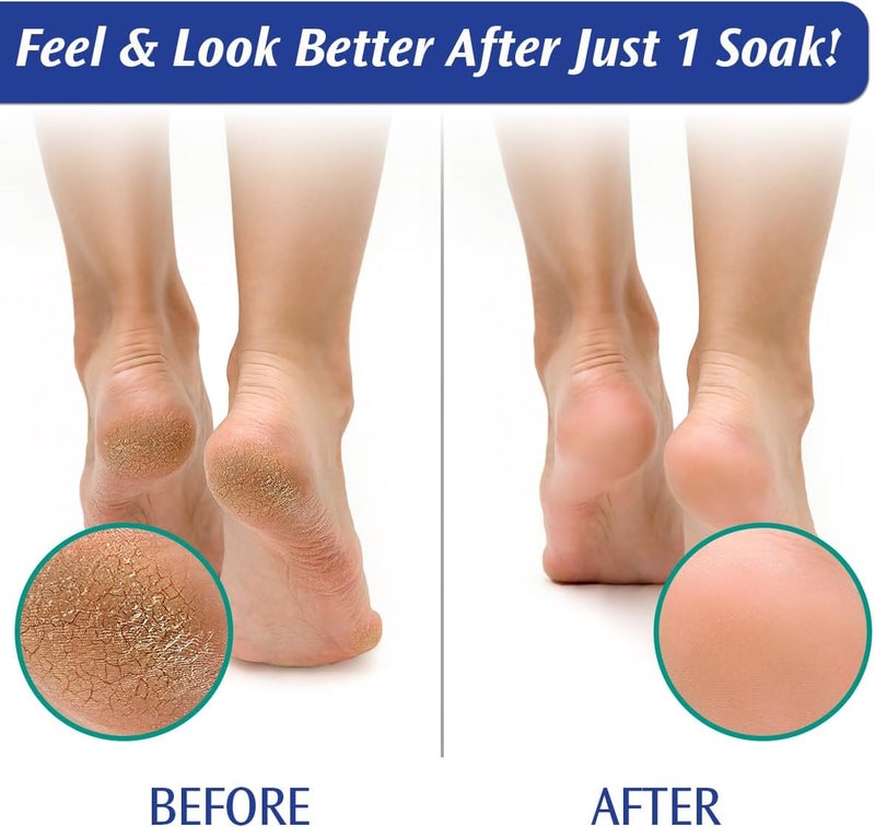 PediFix Soaking Crystals Foot Bath with Tea Tree Oil - 6 Packets of 1 oz Each - Image 3