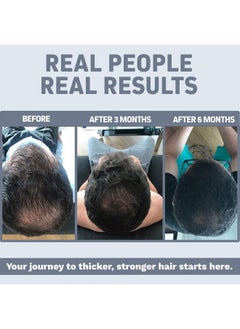 Herbtonics Herbtonics Foli Tonic Hair Growth with Biotin - Hair Vitamins with DHT Blocker, Saw Palmetto, Beta Sitosterol - Promotes Hair Regrowth for Men & Women - Hair Loss Vitamins for Hair Care - 60 Capsules  - Image 2