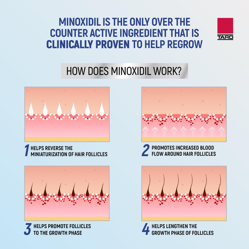 Taro Minoxidil for Men, 2.11 Oz (1 Month Supply) Clinically Proven to Regrow Hair, Topical Aerosol Foam 5%, Hair Thinning Treatment - Image 4