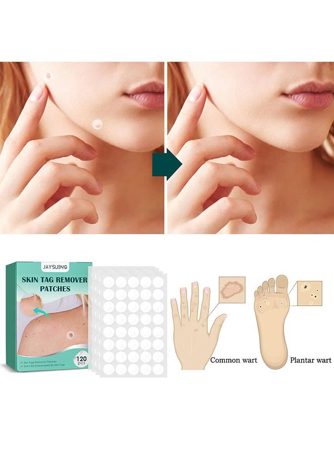 Jaysuing 120 Pcs Skin Tag Remover Patches,Natural Spot Stickers For Face And Skin Care, Beauty Tool.Made With Natural Ingredients Skin Friendly Breathable And Reliable To Use Fast Use Effect.  - Image 2