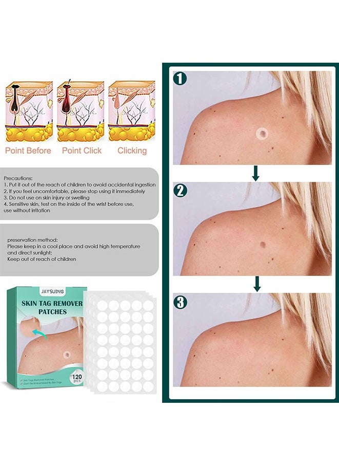 Jaysuing 120 Pcs Skin Tag Remover Patches,Natural Spot Stickers For Face And Skin Care, Beauty Tool.Made With Natural Ingredients Skin Friendly Breathable And Reliable To Use Fast Use Effect.  - Image 4