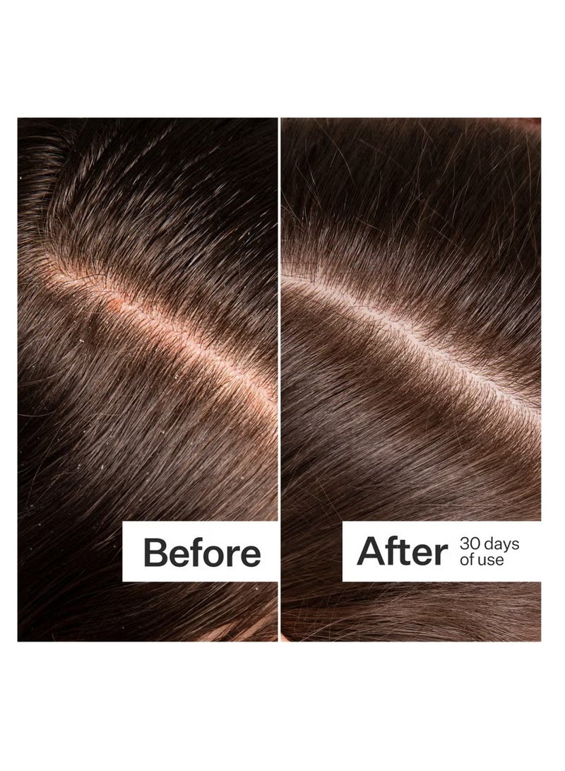 Act+Acre Microbiome Cooling Scalp Serum 65ml - Image 3