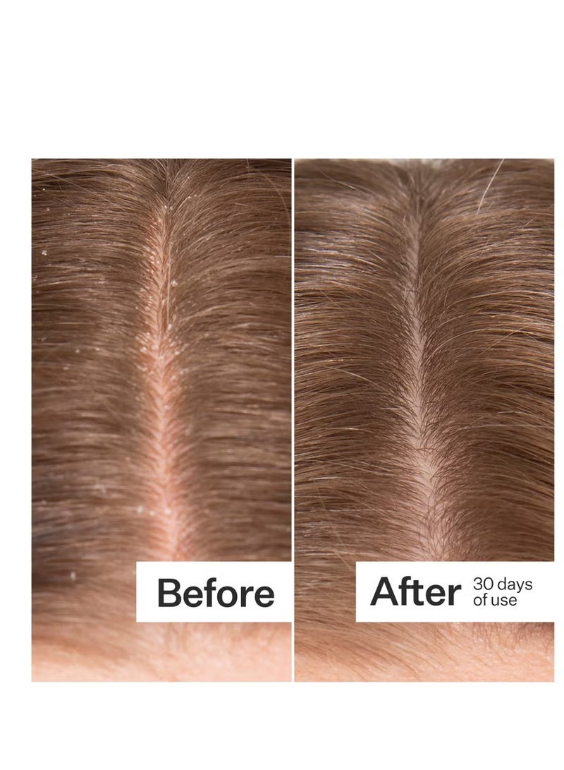 Act+Acre Microbiome Cooling Scalp Serum 65ml - Image 4