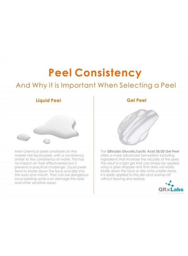 QRxLabs Glycolic/Lactic Acid 30/20 Gel Peel with Calendula, Chamomile and Green Tea Extracts - Professional Grade Chemical Face Peel for Acne Scars, Collagen Boost, Wrinkles, Fine Lines - AHA - 1 fl oz - Image 3