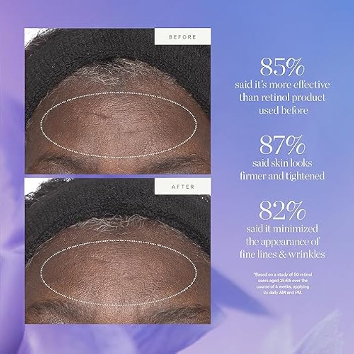 KORA Organics Plant Stem Cell Retinol Alternative Moisturizer, Active Retinol Alternative Blend Smooths Wrinkles and Helps Firm Skin, 0.5 fl oz - Image 4