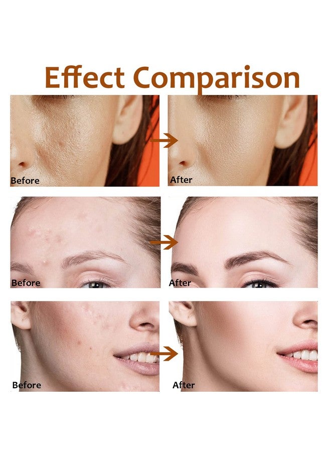 Rosarden Pore Minimizer Serum For Face Pore Minimizer For Face Skin Tightening Shrinking Pores Relieving Dryness Skin Balancing And Firming Moisturizing Serum For Face Oily Skin And Any Types Skin 1Fl Oz - Image 4