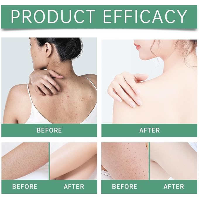 STRBOXONG Skin Fold Comfort Cream for Skin Folds  Cutis Ridge Care Cream  Anti-Friction Gel for Derma Tucks, Soothe Irritated Hide, Professional Chafing Support with Zinc Oxide, Lightweight (3 boxes) - Image 3