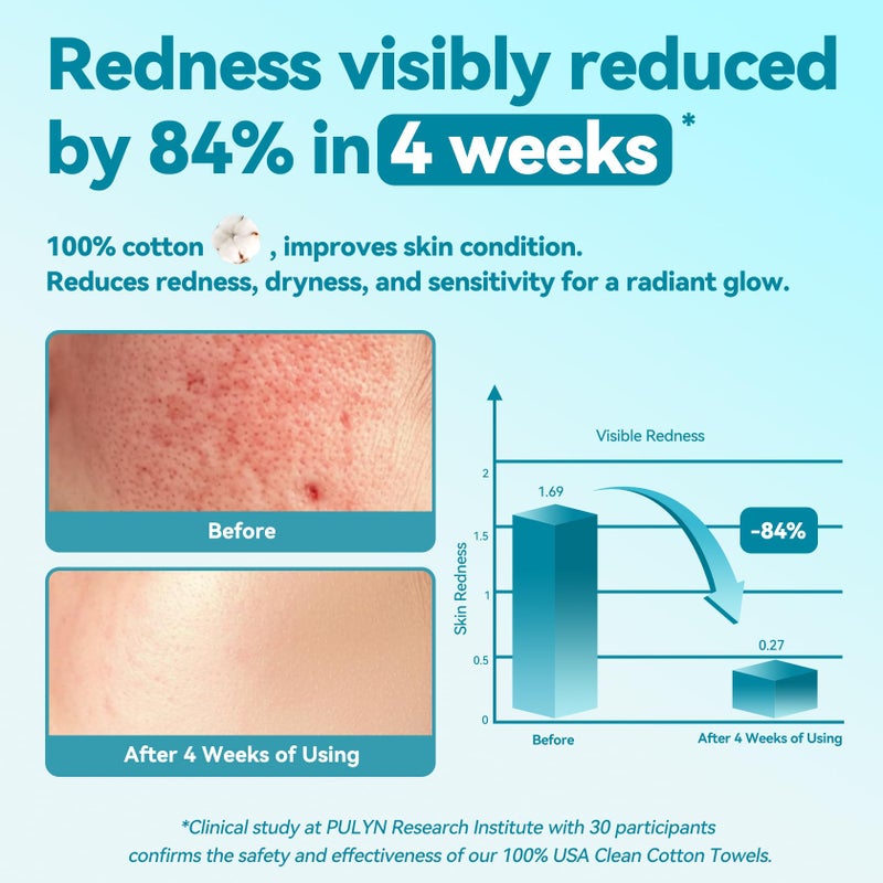 Winner منشفة وجه وينر القابلة للاستخدام مرة واحدة - مناشف وجه قطنية 100% ، قطعة قماش غسيل وجه غير معطرة للبشرة الحساسة ، مناشف وجه فائقة النعومة والسماكة ، مناديل إزالة المكياج الجافة ، 480 قطعة - Image 2