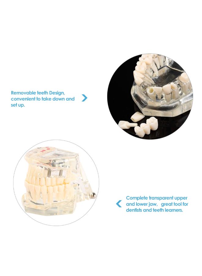 Dental Implantation Disease Teeth Model Multicolour - Image 4