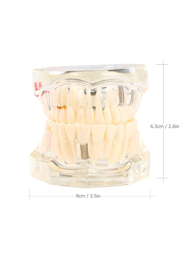 Dental Implantation Disease Teeth Model Multicolour - Image 3