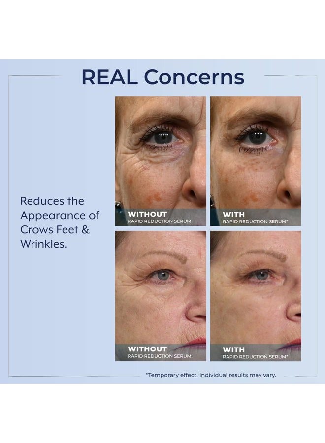 Plexaderm Rapid Reduction Eye Serum - Advanced Formula Anti Aging Visibly Reduces Under-Eye Bags, Wrinkles, Dark Circles, Fine Lines & Crow's Feet Instantly Instant Wrinkle Remover for Face - Image 5