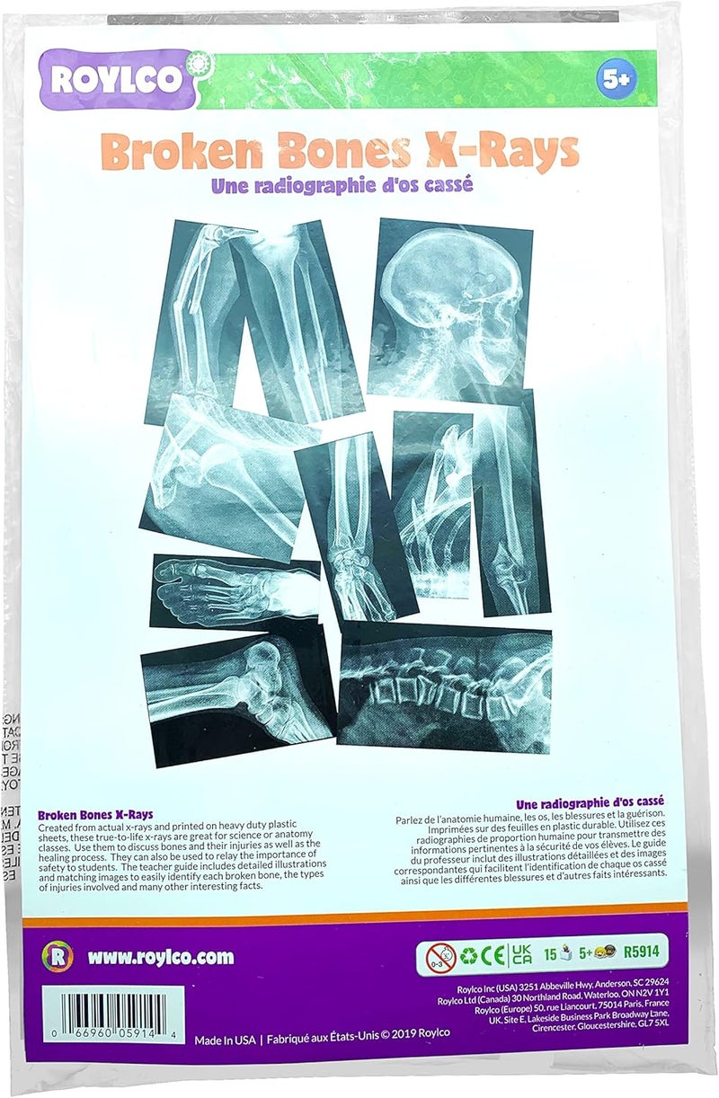 Roylco Broken Bones X-Ray Set for Educational Play - Image 4