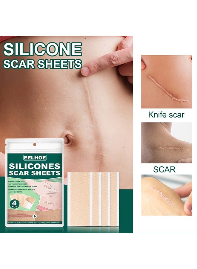 EELHOE Silicones Scar Sheets, Reusable Silicone Scar Tape, Beauty Patch Scar Patch, Scar Removal Away Strips for Keloid, C-Section, Surgery, Burn, Acne et  4Pcs (4*7.5CM) - Image 2
