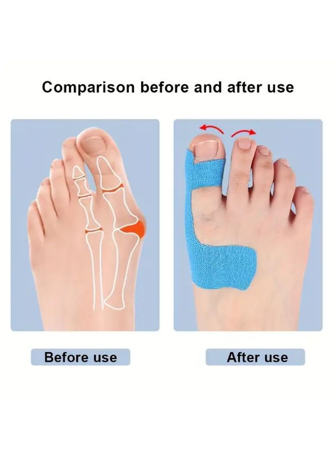 Light Brown Kinesiology Tape Precut 10 Pieces For Foot Comfort Big Toe Support - Image 1