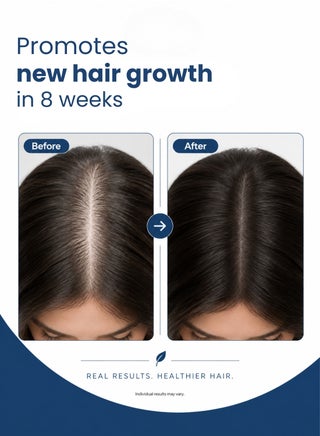 100% Pure Rosemary Oil | 198 ml | For Hair Growth Infused With Biotin | Hair Strenghtening Treatment | Nourishing & Volumizing | With Jojoba Oil & Castor Oil | Non GMO Verified | - view 5