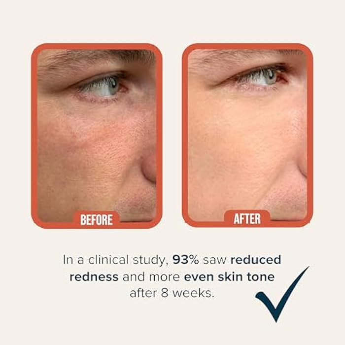 Cardon | Anti-Aging Face Moisturizer for Men | Korean Skincare Facial Lotion | Hydro Boost Gel | Healing Cactus Extract, Reduce Wrinkles, Repair Acne Scars | Ultra Light Face Cream (1 CT) - Image 5