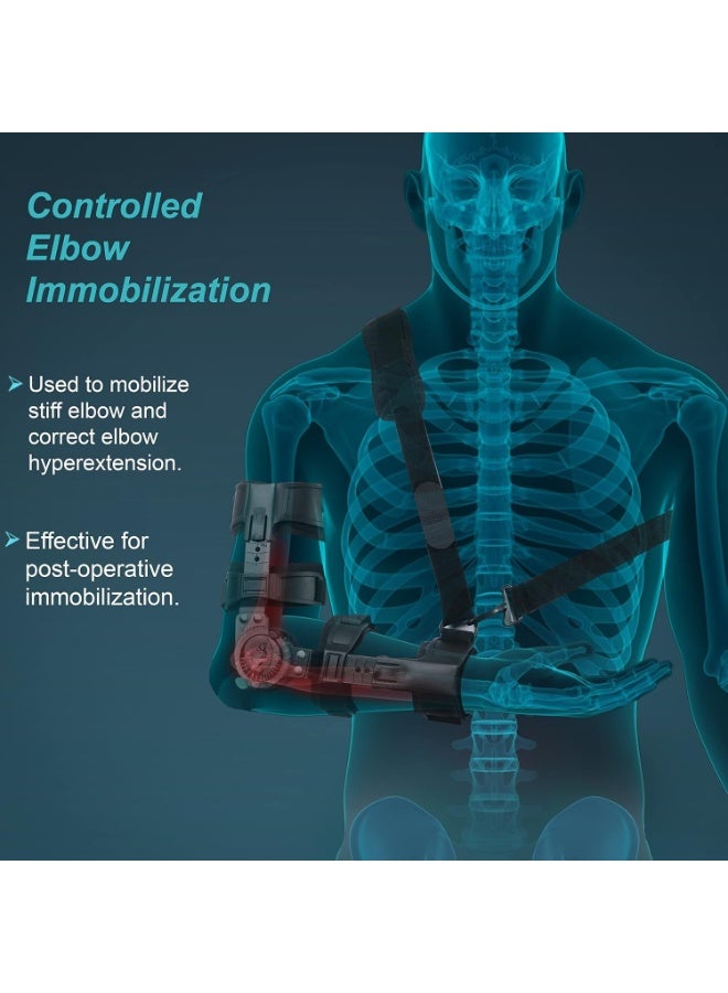 Left ROM Elbow Brace - Adjustable Hinge for Controlled Flexion & Extension with Advanced Disc System - Image 2