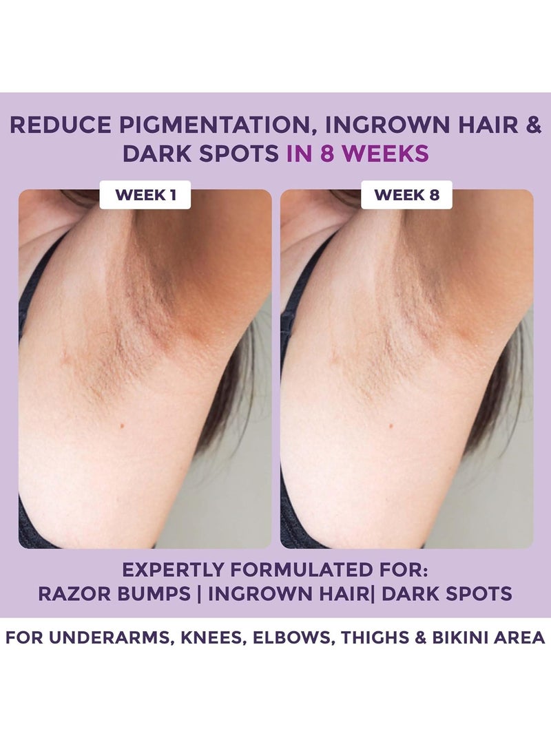 Sanfe Spotlite Ingrown Hair Bumps Scrub Dark Underarms Inner Thighs Sensitive Areas Glycoclear 10% Glycolic Acid Walnut Beads Depigmentation 100gm - Image 2