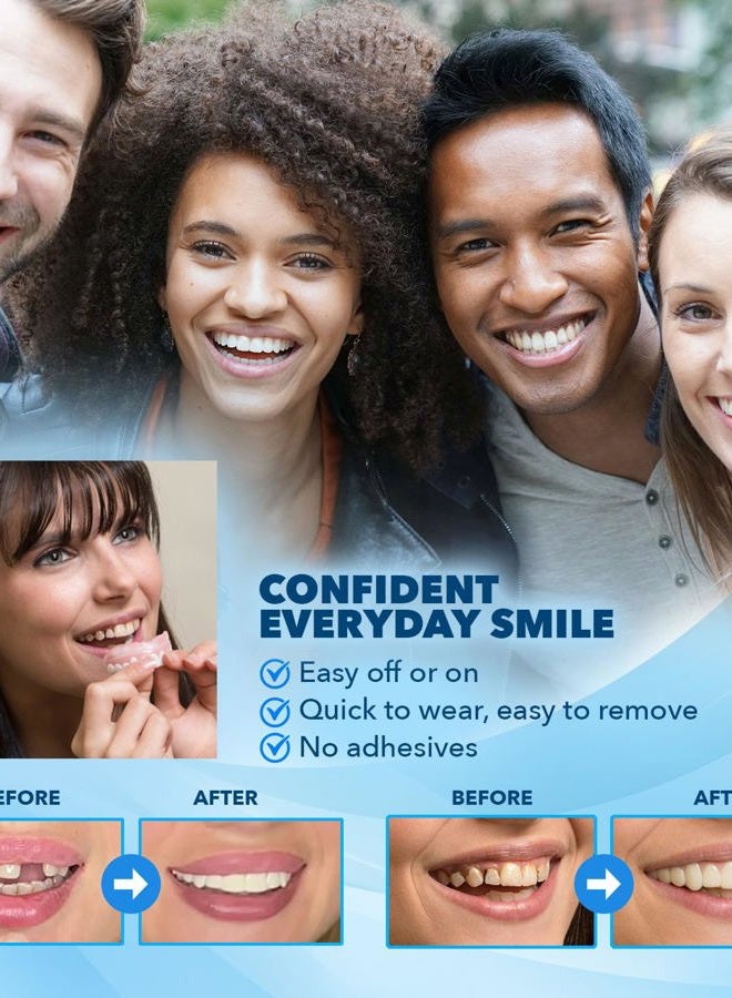 Imako Premium Cosmetic Teeth - 1 Pack - Large, Bleached White - Upper Veneers - Custom Fit at Home, DIY Smile Makeover, Made in USA - Image 3