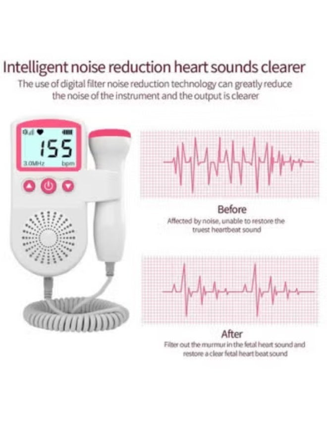 general Portable Ultrasound Doppler Fetal Heart Rate Monitor with LCD Screen - Image 5