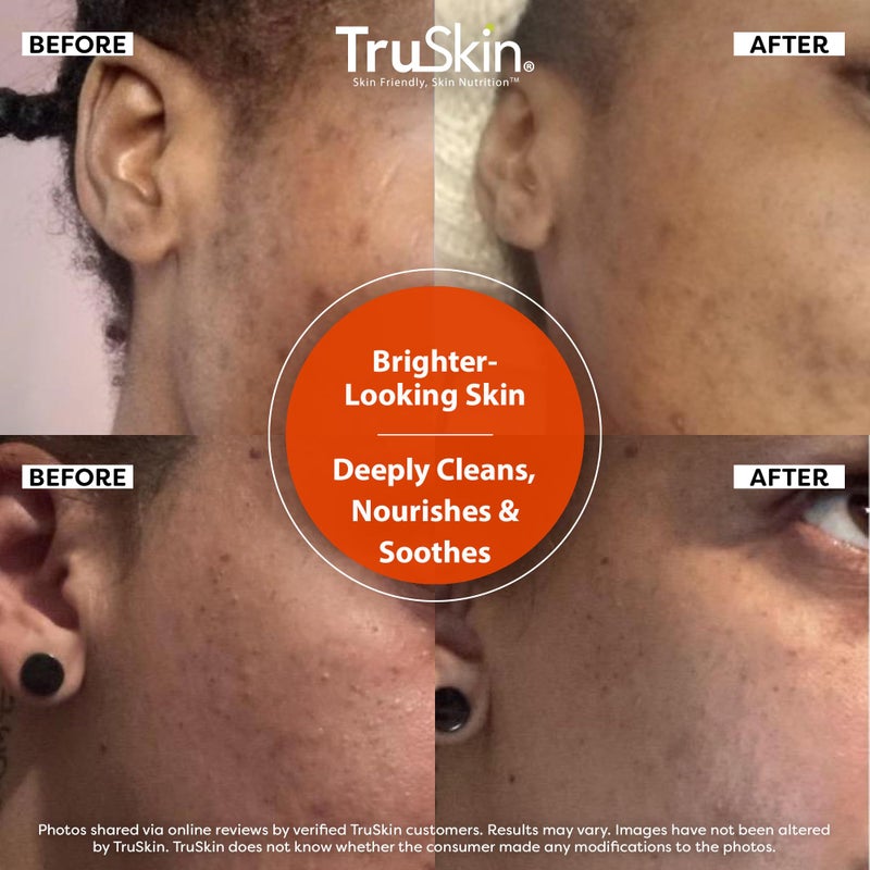 TruSkin Vitamin C Cleanser for Face - Brightening Face Wash with Vitamins C & E, Rosehip Oil, Aloe Vera and MSM - Deep Clean and Refresh for Radiant, Healthy-Looking Skin, 5 fl oz - Image 5