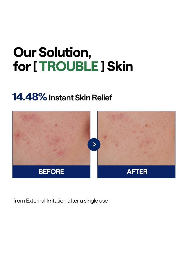MEDIHEAL Tea Tree Calming Hydra Serum 40ml — Lightweight Hydrating Face Serum with Hyaluronic Acid, Tea Tree & Ceramide NP — For Sensitive, Oily & Dry Skin, 1.35 fl oz - Image 5