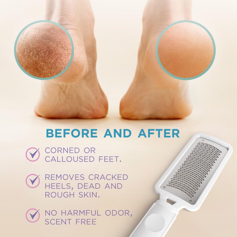 Lee Beauty Professional Callus Remover for Feet-Rasp Foot File Scrubber for Dead Skin Remover for Cracked Heels & Dry Skin-Sturdy Scraper Tool, Easy to Use & Clean-Pedicure Supplies for Smooth Foot - Image 3