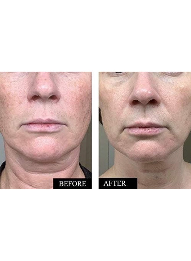 Kleem Organics Professional Age-Defying Vitamin C Serum - Image 2