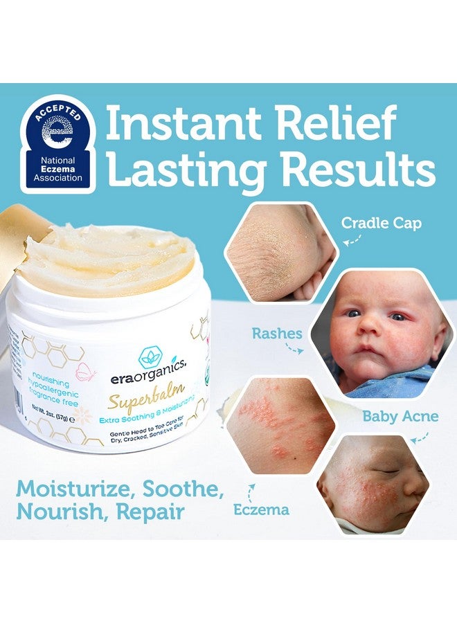 Era Organics Healing Ointment For Babies - Usda Certified Organic Natural Gentle Moisturizer For Sensitive Skin Prone To Baby Eczema, Cradle Cap (Infant Seborrheic Dermatitis), Rashes, Hives & More - Image 3
