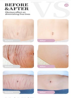 RtopR Mango Pregnancy Scars Cream For Maternity Repair Stretch Marks Enhance Skin Elasticity, Can Promote Cell Regeneration, Repair Necrotic Cells, Designed For Mother's Stretch Marks  - Image 4
