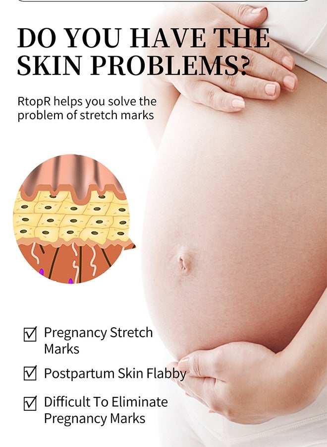 RtopR Mango Pregnancy Scars Cream For Maternity Repair Stretch Marks Enhance Skin Elasticity, Can Promote Cell Regeneration, Repair Necrotic Cells, Designed For Mother's Stretch Marks - Image 2
