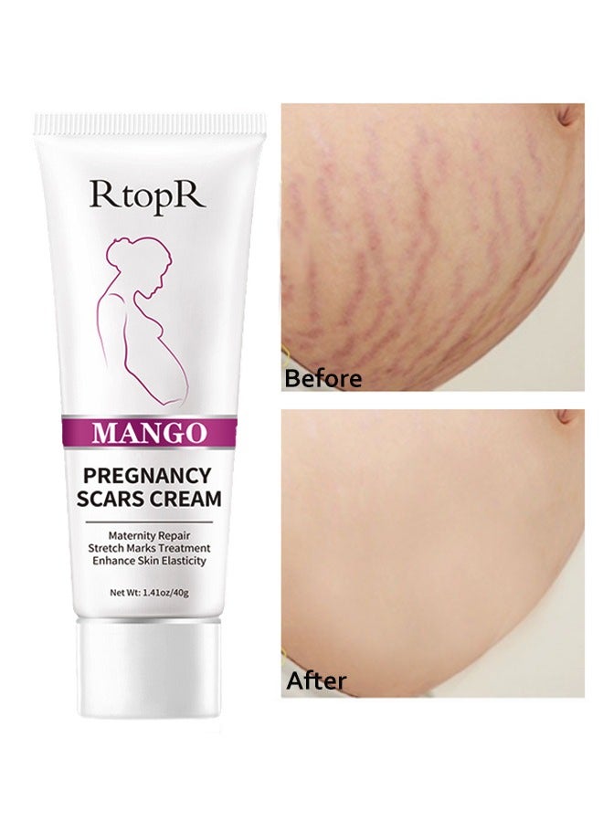 RtopR Mango Pregnancy Scars Cream For Maternity Repair Stretch Marks Enhance Skin Elasticity, Can Promote Cell Regeneration, Repair Necrotic Cells, Designed For Mother's Stretch Marks - Image 1
