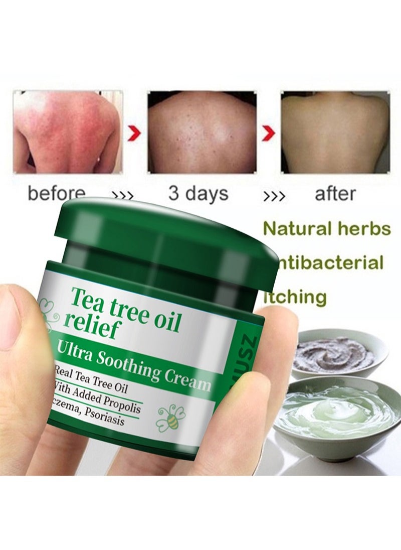 HEALMUSZ - Ultra Soothing Cream 100% Chinese Herbal Eczema Psoriasis Creams,Tea Tree Oil Relief Dermatitis and Eczema Pruritus Psoriasis Anti-chitch Ointment - Image 1