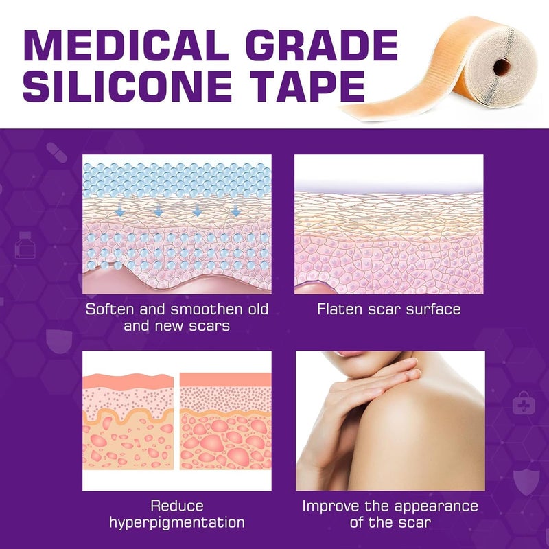 Kelinul Silicone Scar Sheets16 x 60Roll15M  Soft Silicone Gel Scar Tape Painless Silicone Tape Roll  Reusable Medical Grade Silicone Scar Removal Strips for CSectio - Image 2