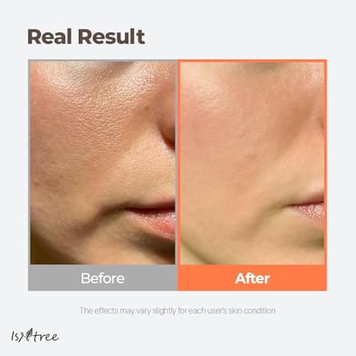 ISNTREE Green Tea Fresh Toner 200ml, 6.76 fl.oz | Korean Skincare | Toner for Oily Skin | Sebum Control | Hydrating and Refreshing - Image 4