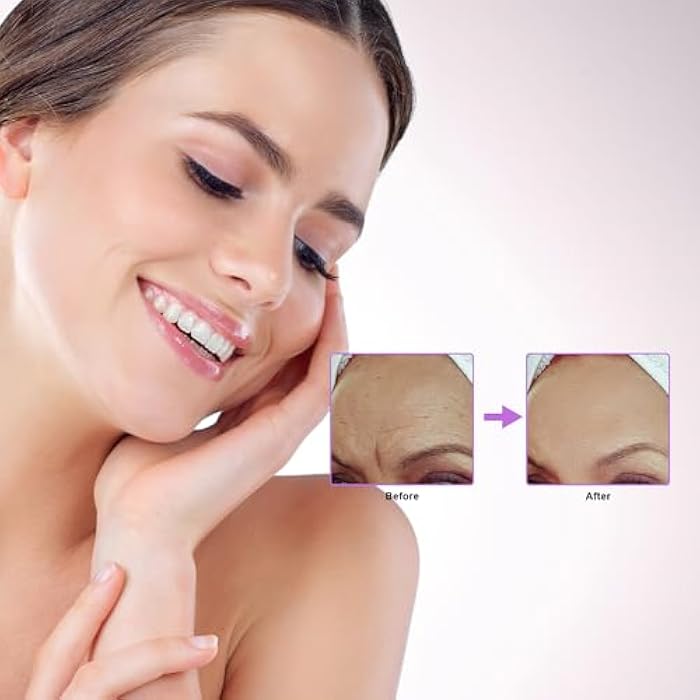 Elitzia CO₂ Facial Kit - 6 Sets/Box for CO₂ Oxygen Facial Machine, Skin Nourishing & Barrier Fortifying ETD24BD3 (Nourish & Fortify Formula) - Image 3