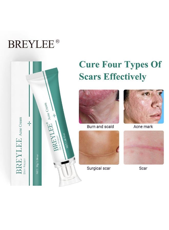 Breylee Herbal Repair Cream Effectively Heals Four Types Of Scars 30g - Image 5