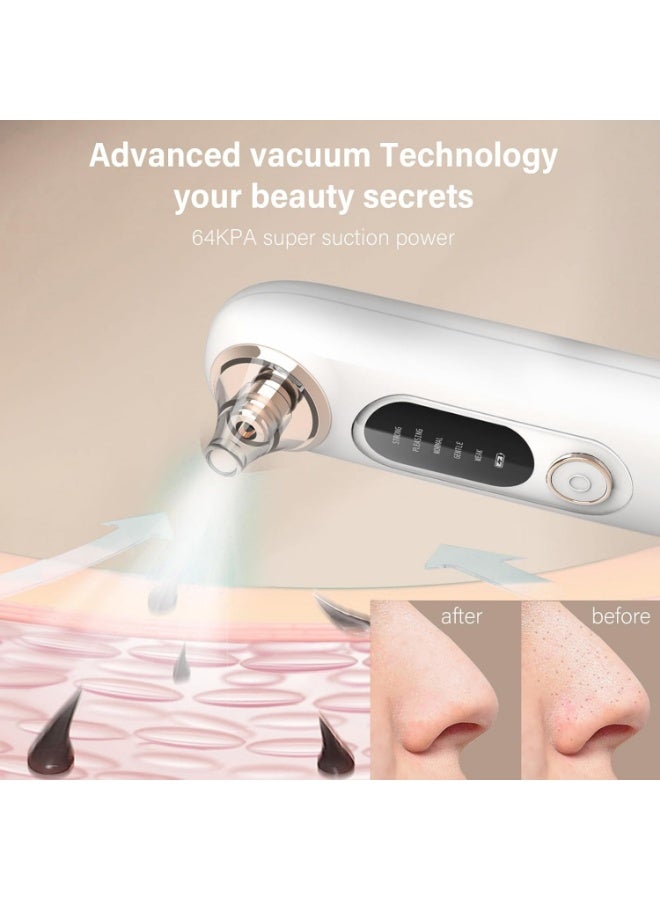 مجموعة شفط مسام الوجه لإزالة الرؤوس السوداء، 5 مستويات شفط قابلة للتعديل، أداة استخراج الرؤوس السوداء، منظف مسام الوجه بالشفط مع 4 رؤوس شفط، 4 مجسات للنساء والرجال (أبيض) - Image 3